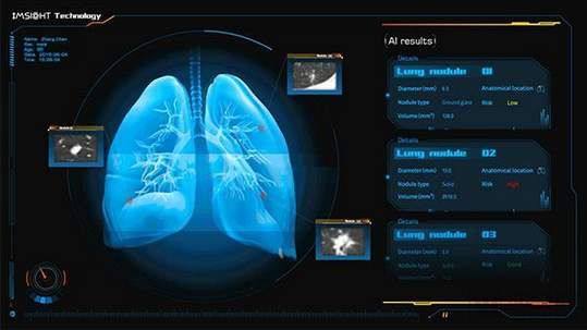 為了我們的健康 以AI賦能智能抗疫，數據處理與存儲支持服務探析